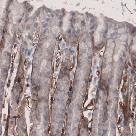 Immunohistochemistry (Formalin/PFA-fixed paraffin-embedded sections) - Anti-Laminin alpha 4/LAMA4 antibody [CL3183] (AB242198)