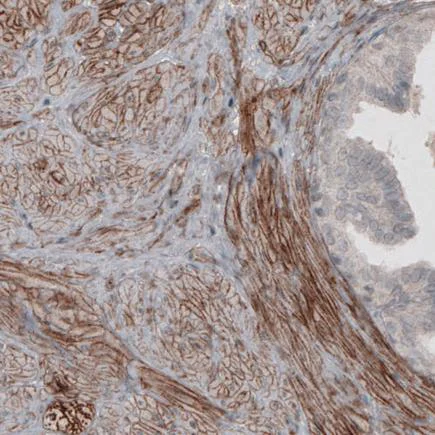 Immunohistochemistry (Formalin/PFA-fixed paraffin-embedded sections) - Anti-Laminin alpha 4/LAMA4 antibody [CL3183] (AB242198)