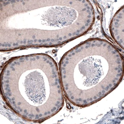 Immunohistochemistry (Formalin/PFA-fixed paraffin-embedded sections) - Anti-Laminin alpha 4/LAMA4 antibody [CL3183] (AB242198)