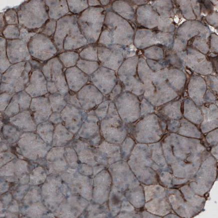 Immunohistochemistry (Formalin/PFA-fixed paraffin-embedded sections) - Anti-Laminin alpha 4/LAMA4 antibody [CL3183] (AB242198)