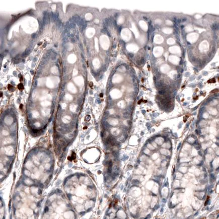 Immunohistochemistry (Formalin/PFA-fixed paraffin-embedded sections) - Anti-Laminin alpha 4/LAMA4 antibody [CL3183] (AB242198)