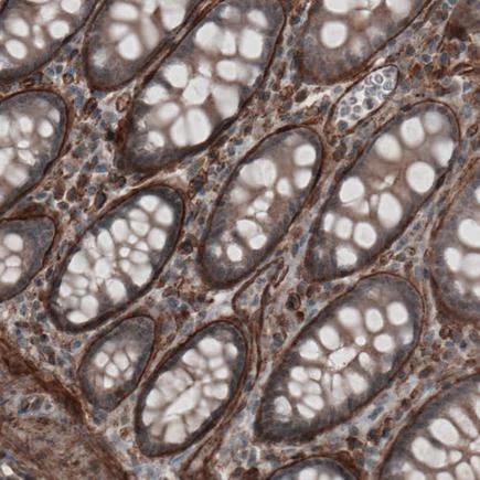 Immunohistochemistry (Formalin/PFA-fixed paraffin-embedded sections) - Anti-Laminin alpha 4/LAMA4 antibody [CL3183] (AB242198)