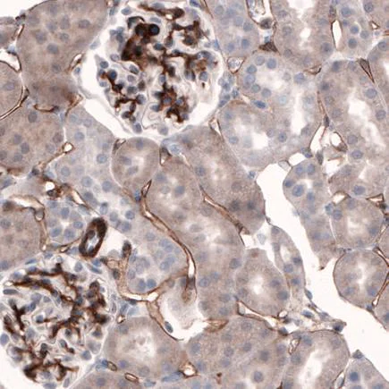 Immunohistochemistry (Formalin/PFA-fixed paraffin-embedded sections) - Anti-Laminin alpha 4/LAMA4 antibody [CL3183] (AB242198)