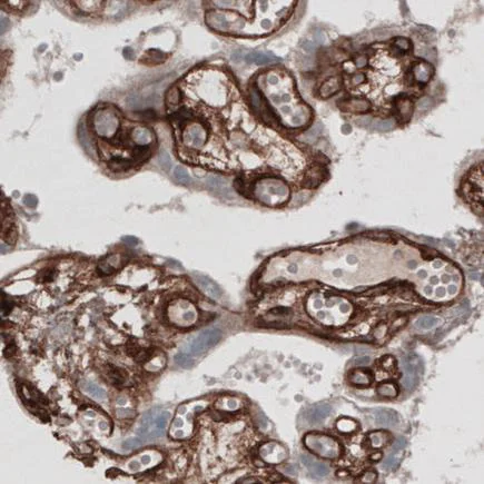 Immunohistochemistry (Formalin/PFA-fixed paraffin-embedded sections) - Anti-Laminin alpha 4/LAMA4 antibody [CL3183] (AB242198)