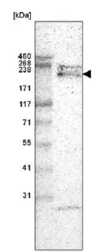 Western blot - Anti-Laminin alpha 4/LAMA4 antibody [CL3183] (AB242198)