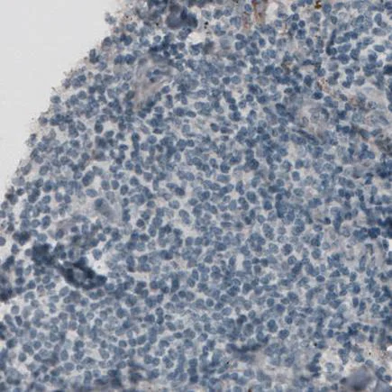 Immunohistochemistry (Formalin/PFA-fixed paraffin-embedded sections) - Anti-Laminin alpha 4/LAMA4 antibody [CL3185] (AB242359)