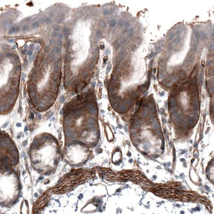 Immunohistochemistry (Formalin/PFA-fixed paraffin-embedded sections) - Anti-Laminin alpha 4/LAMA4 antibody [CL3185] (AB242359)