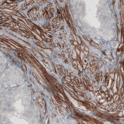 Immunohistochemistry (Formalin/PFA-fixed paraffin-embedded sections) - Anti-Laminin alpha 4/LAMA4 antibody [CL3185] (AB242359)