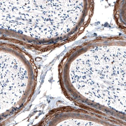Immunohistochemistry (Formalin/PFA-fixed paraffin-embedded sections) - Anti-Laminin alpha 4/LAMA4 antibody [CL3185] (AB242359)