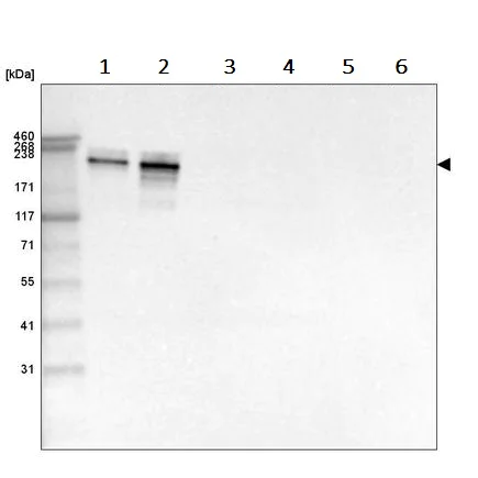 Western blot - Anti-Laminin alpha 4/LAMA4 antibody [CL3185] (AB242359)