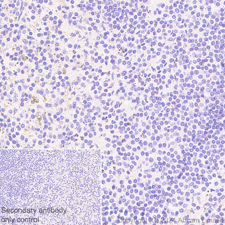 Immunohistochemistry (Formalin/PFA-fixed paraffin-embedded sections) - Anti-Laminin alpha 4/LAMA4 antibody [EPR28287-61] (AB321978)