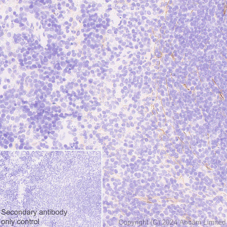 Immunohistochemistry (Formalin/PFA-fixed paraffin-embedded sections) - Anti-Laminin alpha 4/LAMA4 antibody [EPR28287-61] - BSA and Azide free (AB321979)