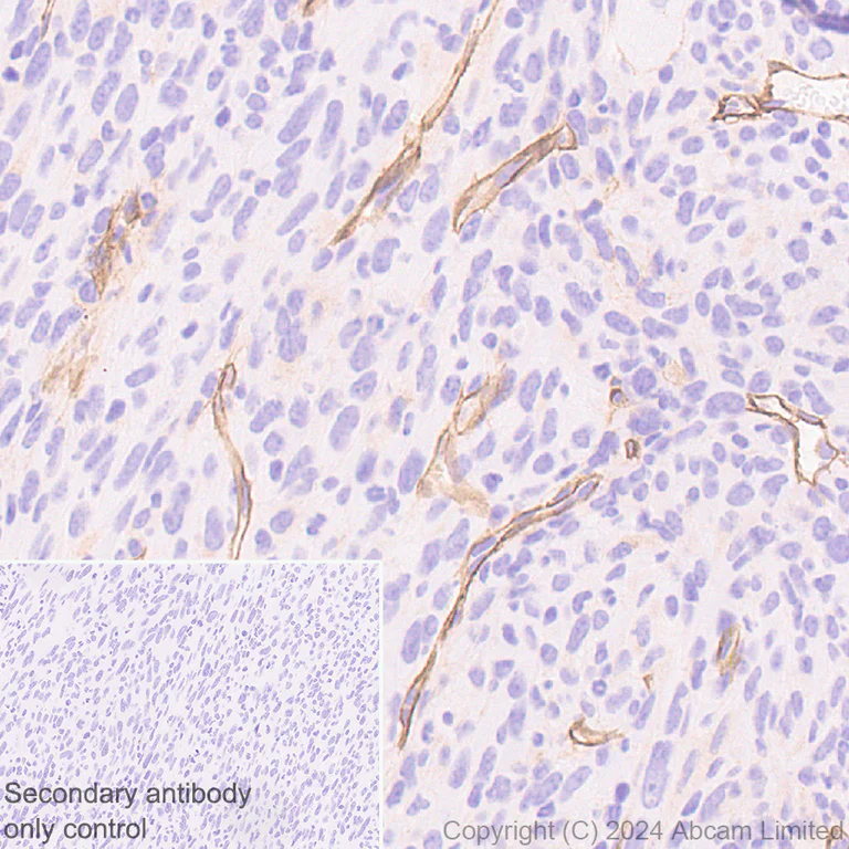 Immunohistochemistry (Formalin/PFA-fixed paraffin-embedded sections) - Anti-Laminin alpha 4/LAMA4 antibody [EPR28287-61] - BSA and Azide free (AB321979)