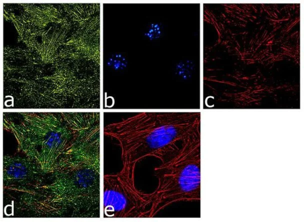Immunocytochemistry/ Immunofluorescence - Anti-Laminin alpha 4/LAMA4 Antibody [RP23040173] (AB313467)