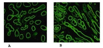Immunocytochemistry/ Immunofluorescence - Anti-Laminin alpha 5/LAMA5 antibody [4B12] (AB77175)