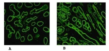 Immunocytochemistry/ Immunofluorescence - Anti-Laminin alpha 5/LAMA5 antibody [4B12] (AB77175)