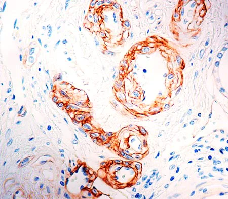 Immunohistochemistry (Formalin/PFA-fixed paraffin-embedded sections) - Anti-Laminin alpha 5/LAMA5 antibody [4C7] (AB17107)