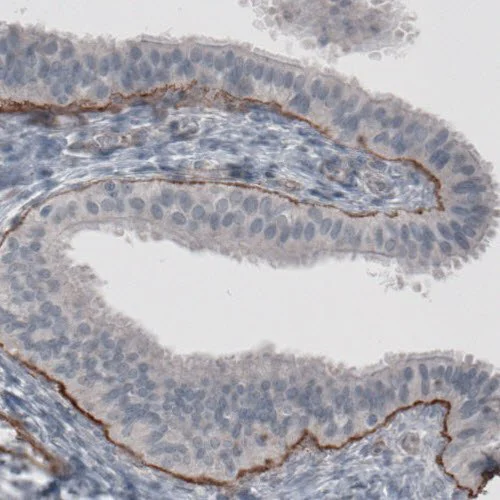 Immunohistochemistry (Formalin/PFA-fixed paraffin-embedded sections) - Anti-Laminin alpha 5/LAMA5 antibody [CL3118] (AB210957)