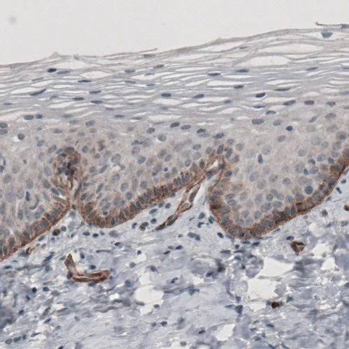 Immunohistochemistry (Formalin/PFA-fixed paraffin-embedded sections) - Anti-Laminin alpha 5/LAMA5 antibody [CL3118] (AB210957)