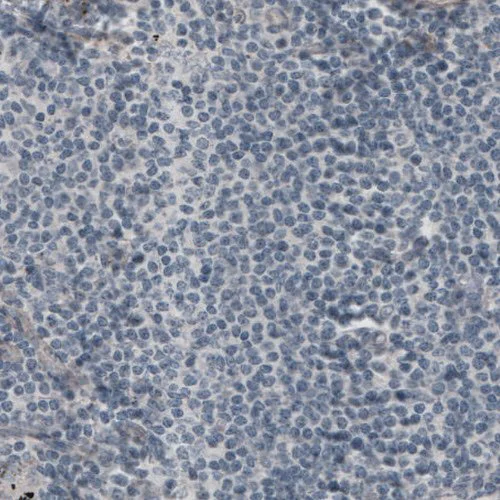 Immunohistochemistry (Formalin/PFA-fixed paraffin-embedded sections) - Anti-Laminin alpha 5/LAMA5 antibody [CL3118] (AB210957)