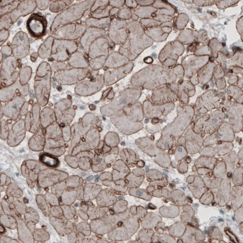 Immunohistochemistry (Formalin/PFA-fixed paraffin-embedded sections) - Anti-Laminin alpha 5/LAMA5 antibody [CL3118] (AB210957)