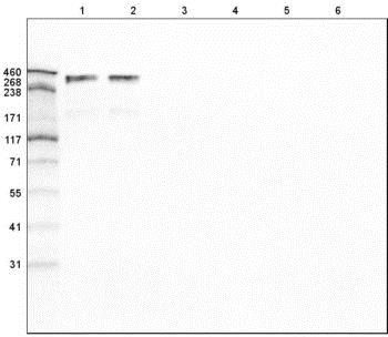 Western blot - Anti-Laminin alpha 5/LAMA5 antibody [CL3118] (AB210957)
