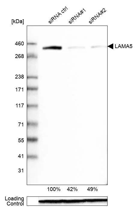 Western blot - Anti-Laminin alpha 5/LAMA5 antibody [CL3118] (AB210957)