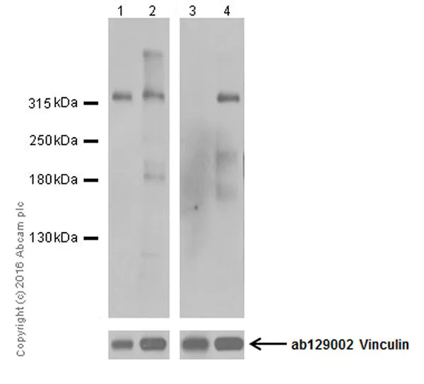 Western blot - Anti-Laminin alpha 5/LAMA5 antibody [EPR18919] (AB184330)