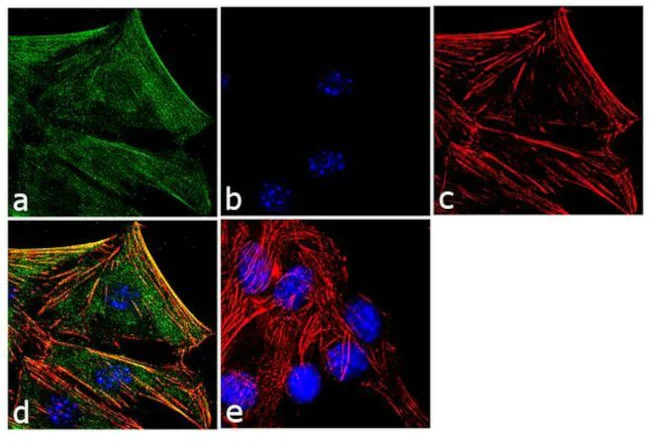 Immunocytochemistry/ Immunofluorescence - Anti-Laminin Antibody [RP23040175] (AB313469)