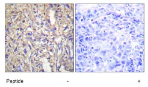 Immunohistochemistry (Formalin/PFA-fixed paraffin-embedded sections) - Anti-Laminin beta 1 antibody (AB69633)