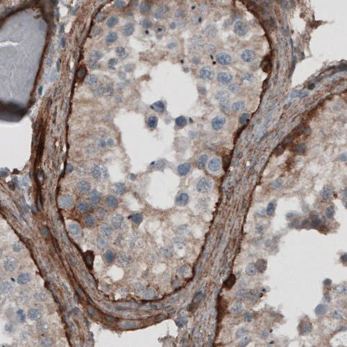 Immunohistochemistry (Formalin/PFA-fixed paraffin-embedded sections) - Anti-Laminin beta 2 antibody [CL2979] (AB210956)