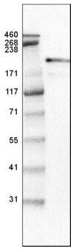 Western blot - Anti-Laminin beta 2 antibody [CL2979] (AB210956)