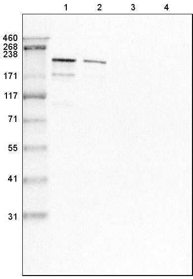 Western blot - Anti-Laminin beta 2 antibody [CL2979] (AB210956)