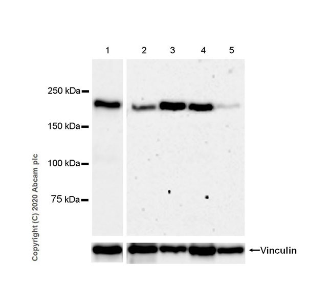 Western blot - Anti-Laminin beta 2 antibody [EPR23568-91] (AB277521), expandable thumbnail