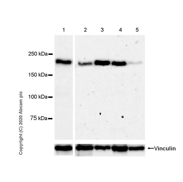 Western blot - Anti-Laminin beta 2 antibody [EPR23568-91] (AB277521)
