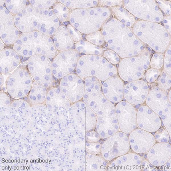 Immunohistochemistry (Formalin/PFA-fixed paraffin-embedded sections) - Anti-Laminin gamma 1 antibody [EPR21199] (AB233389)
