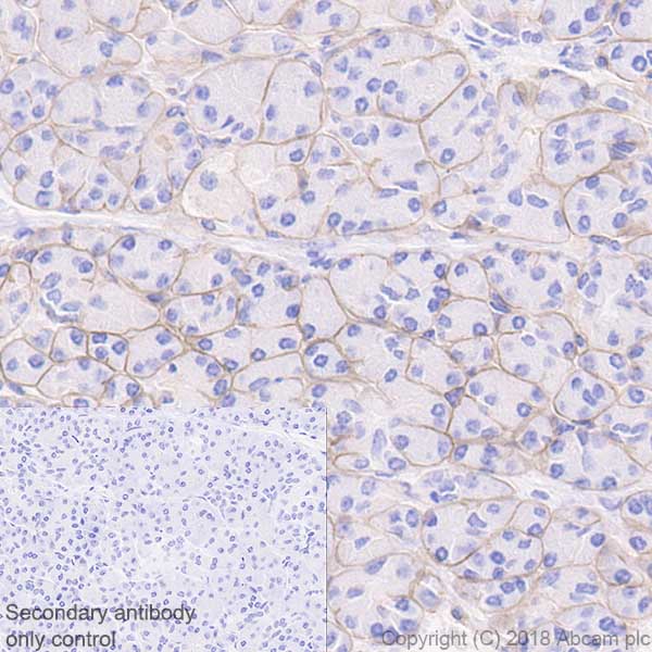 Immunohistochemistry (Formalin/PFA-fixed paraffin-embedded sections) - Anti-Laminin gamma 1 antibody [EPR21199] (AB233389)