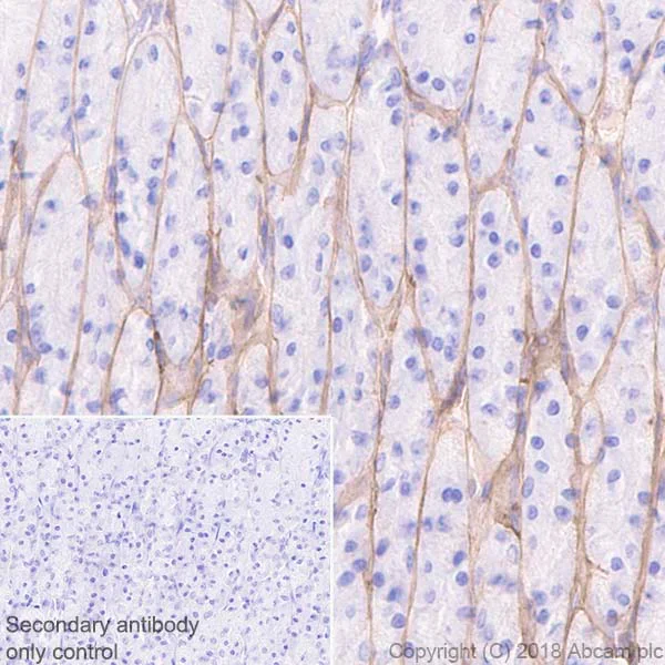 Immunohistochemistry (Formalin/PFA-fixed paraffin-embedded sections) - Anti-Laminin gamma 1 antibody [EPR21199] (AB233389)