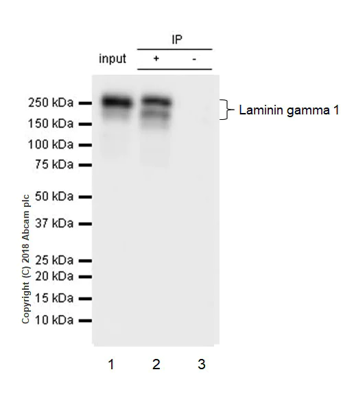 Immunoprecipitation - Anti-Laminin gamma 1 antibody [EPR21199] (AB233389)