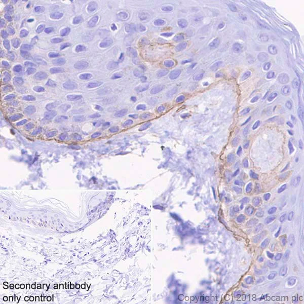 Immunohistochemistry (Formalin/PFA-fixed paraffin-embedded sections) - Anti-Laminin gamma 1 antibody [EPR21200] (AB233390)