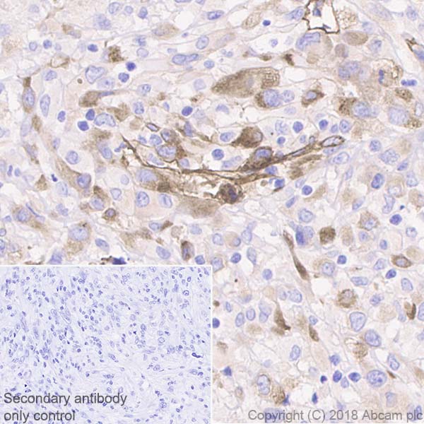 Immunohistochemistry (Formalin/PFA-fixed paraffin-embedded sections) - Anti-Laminin gamma 1 antibody [EPR21200] (AB233390)