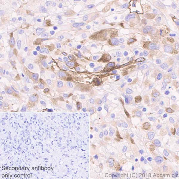 Immunohistochemistry (Formalin/PFA-fixed paraffin-embedded sections) - Anti-Laminin gamma 1 antibody [EPR21200] (AB233390)
