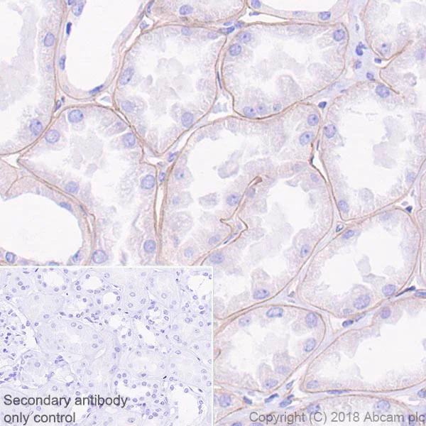 Immunohistochemistry (Formalin/PFA-fixed paraffin-embedded sections) - Anti-Laminin gamma 1 antibody [EPR21200] (AB233390)