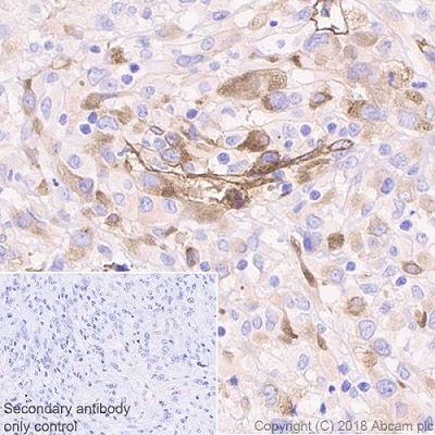 Immunohistochemistry (Formalin/PFA-fixed paraffin-embedded sections) - Anti-Laminin gamma 1 antibody [EPR21200] - BSA and Azide free (AB234959)