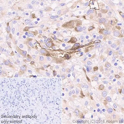 Immunohistochemistry (Formalin/PFA-fixed paraffin-embedded sections) - Anti-Laminin gamma 1 antibody [EPR21200] - BSA and Azide free (AB234959)