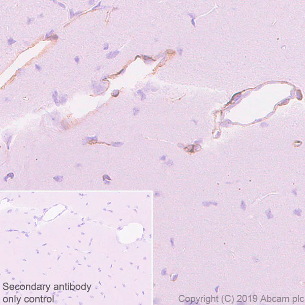 Immunohistochemistry (Formalin/PFA-fixed paraffin-embedded sections) - Anti-Laminin gamma 3 antibody [EPR22699-151] (AB234429)