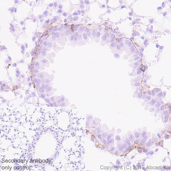 Immunohistochemistry (Formalin/PFA-fixed paraffin-embedded sections) - Anti-Laminin gamma 3 antibody [EPR22699-151] - BSA and Azide free (AB267391), expandable thumbnail
