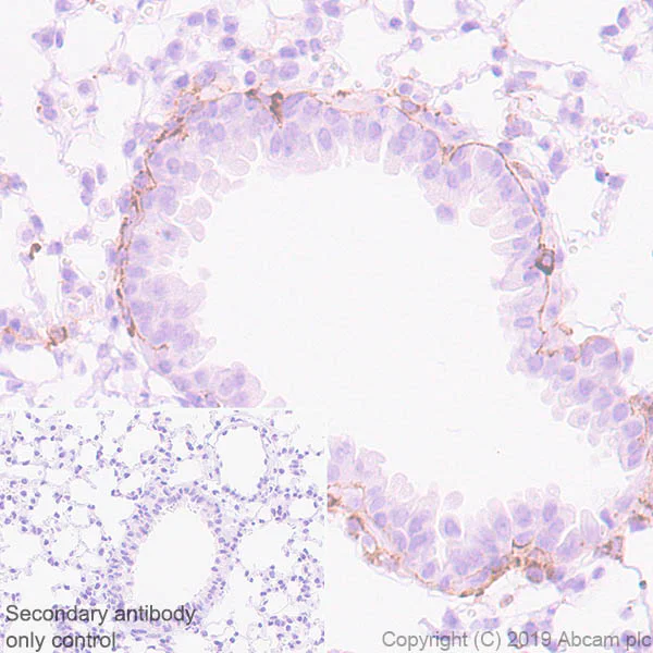 Immunohistochemistry (Formalin/PFA-fixed paraffin-embedded sections) - Anti-Laminin gamma 3 antibody [EPR22699-151] - BSA and Azide free (AB267391)