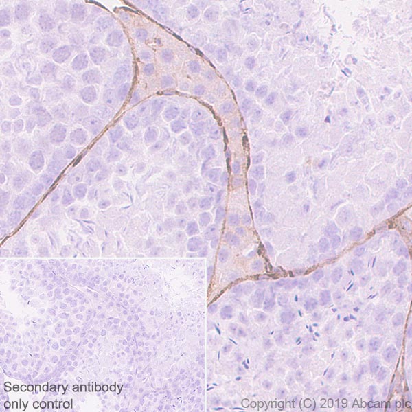 Immunohistochemistry (Formalin/PFA-fixed paraffin-embedded sections) - Anti-Laminin gamma 3 antibody [EPR22699-151] - BSA and Azide free (AB267391), expandable thumbnail