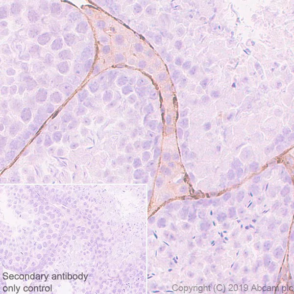 Immunohistochemistry (Formalin/PFA-fixed paraffin-embedded sections) - Anti-Laminin gamma 3 antibody [EPR22699-151] - BSA and Azide free (AB267391)